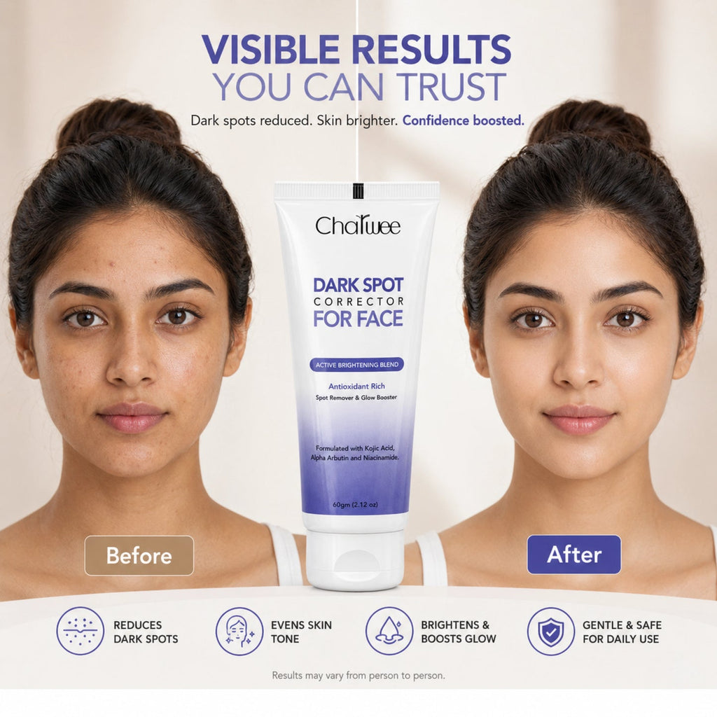 Charwee Dark Spots Corrector Cream | Imported Formula with Niacinamide | Allow to Open Parcel 📦