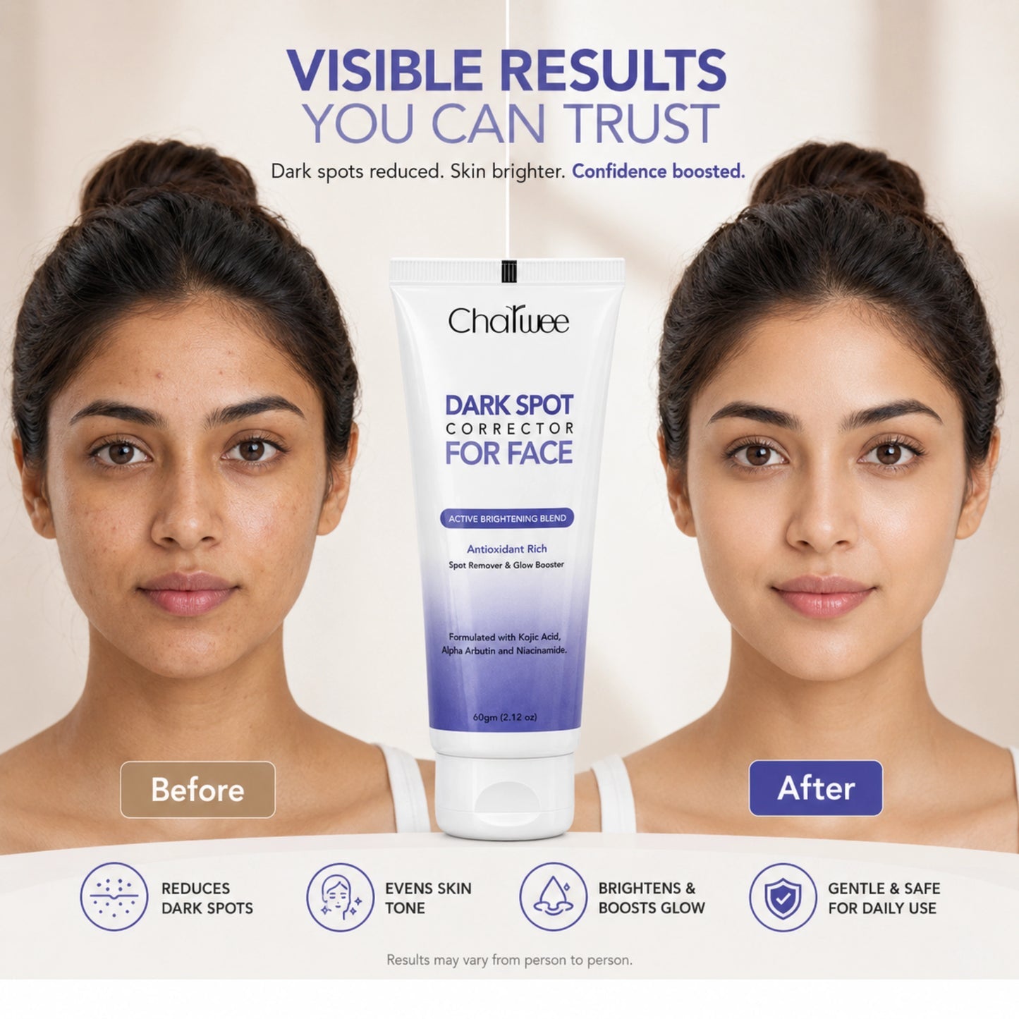 Charwee Dark Spots Corrector Cream | Imported Formula with Niacinamide | Allow to Open Parcel 📦