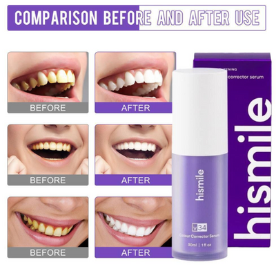 Hismile Teeth Whitening Serum